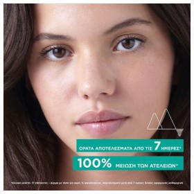 Uriage Hyseac New Skin Serum, Ορός Προσώπου για Λιπαρό Δέρμα με Ατέλειες 40ml – φωτογραφία 3